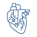 Artificial Heart or LVAD